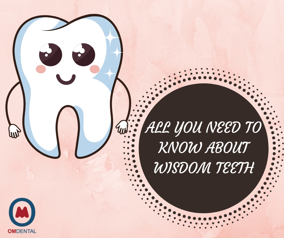 What are wisdom teeth and the right time to get them out